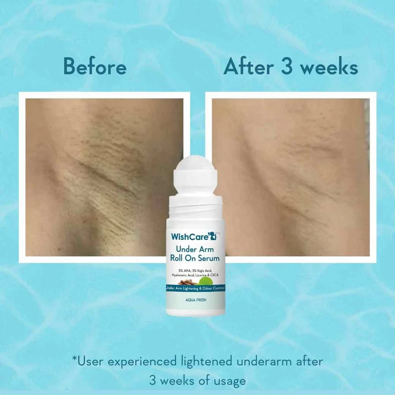 WishCare Under Arm Roll On Serum 50ml